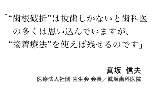 接着療法の第一人者である眞坂信夫先生。即抜歯と言われる歯根破折も、接着で延命させることができる。