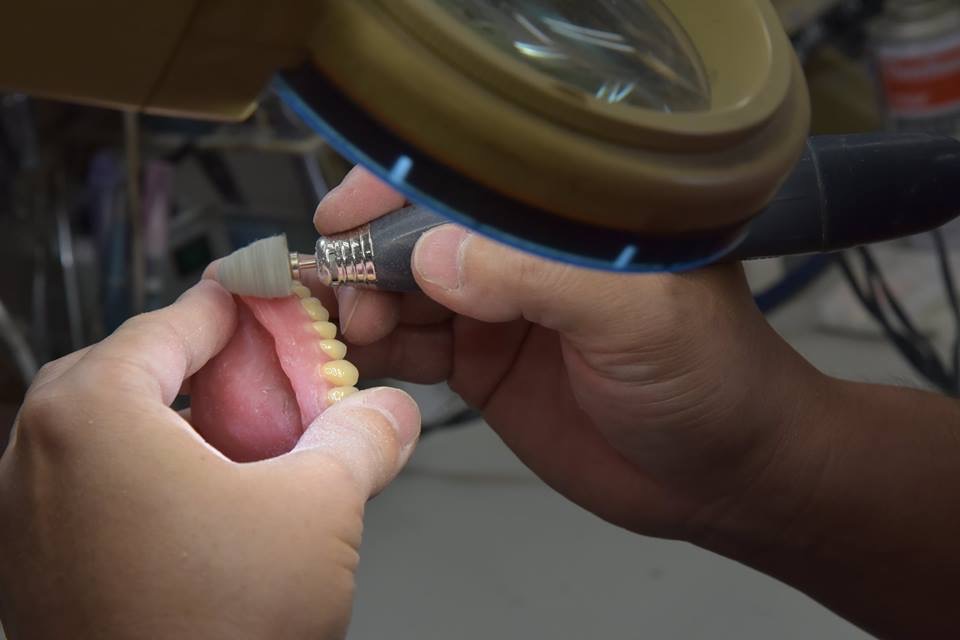 歯科技工士が手作業で作る義歯
